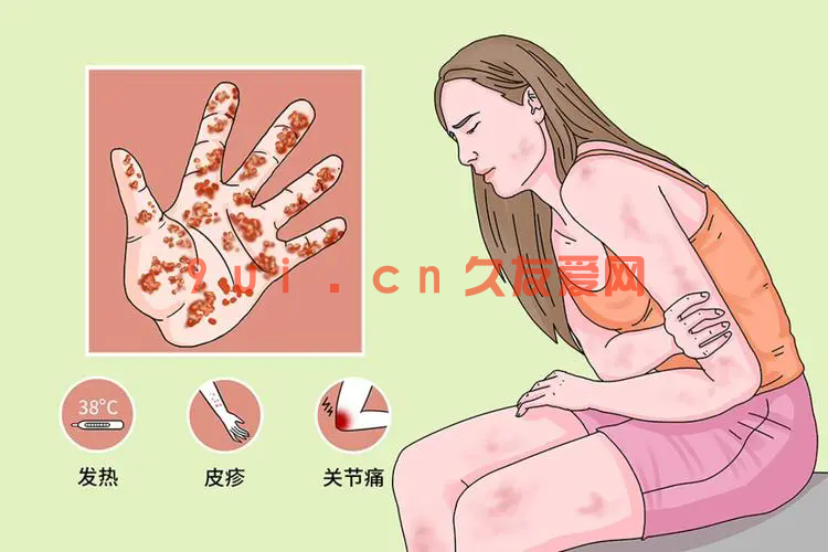 女性性病：六大预警信号不容忽视的健康警报